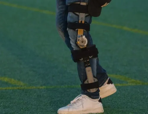 Heeft een kniebrace zin? Dit hangt af van je klacht